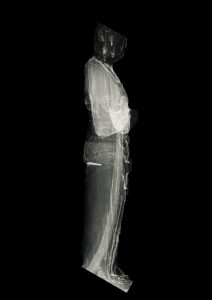 Fig4_Tan_S3920_Radiograph_SideView